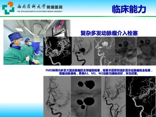 學科領航 平臺賦能 四川省神外臨床醫學研究中心建設與發展——西南醫大附院陳禮剛團隊的醫學研究探索